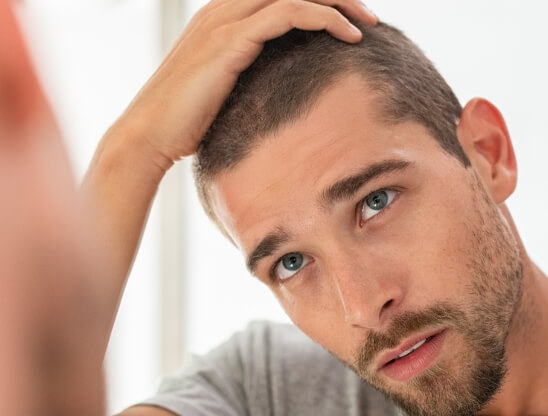 Hair Loss