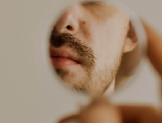 Cold Sores