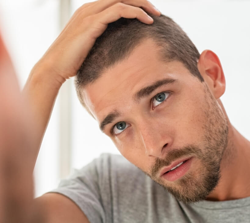hair-loss